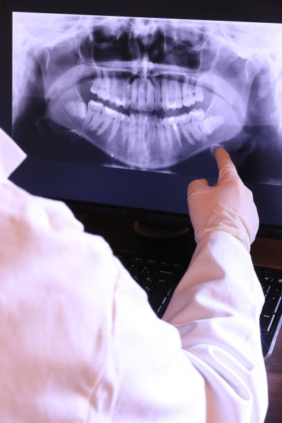 Best Knocked-Out Tooth (Avulsed Tooth) Treatment in Woodville, TX
